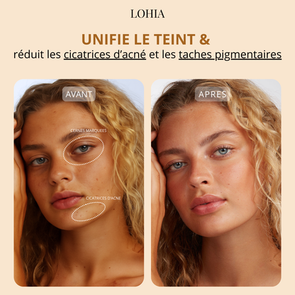 Fond de teint Sérum Lohia