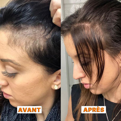 Shampoing à l'eau de riz pour la densité des cheveux